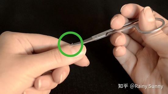 孩子手上长倒刺是什么原因?应该怎么处理?