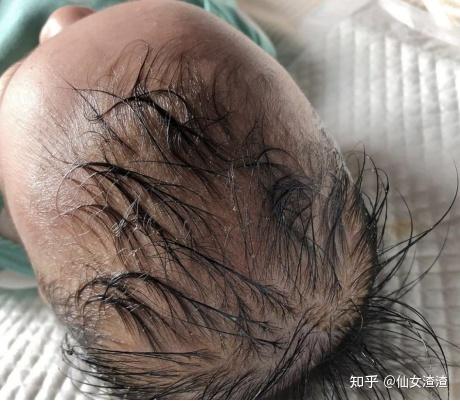 也特别适合新生儿,敏感肌,里面的橄榄油还能辅助去除宝宝头上的胎脂