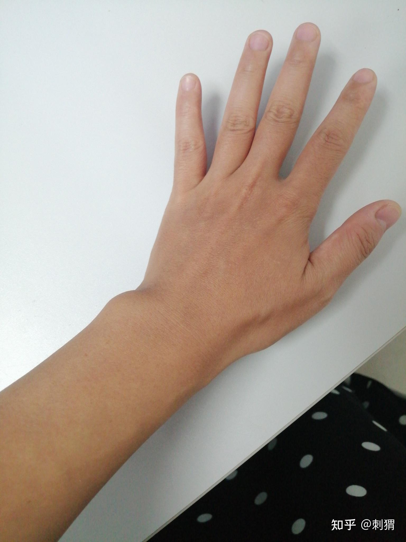 这黑黑的手戴什么手镯好?