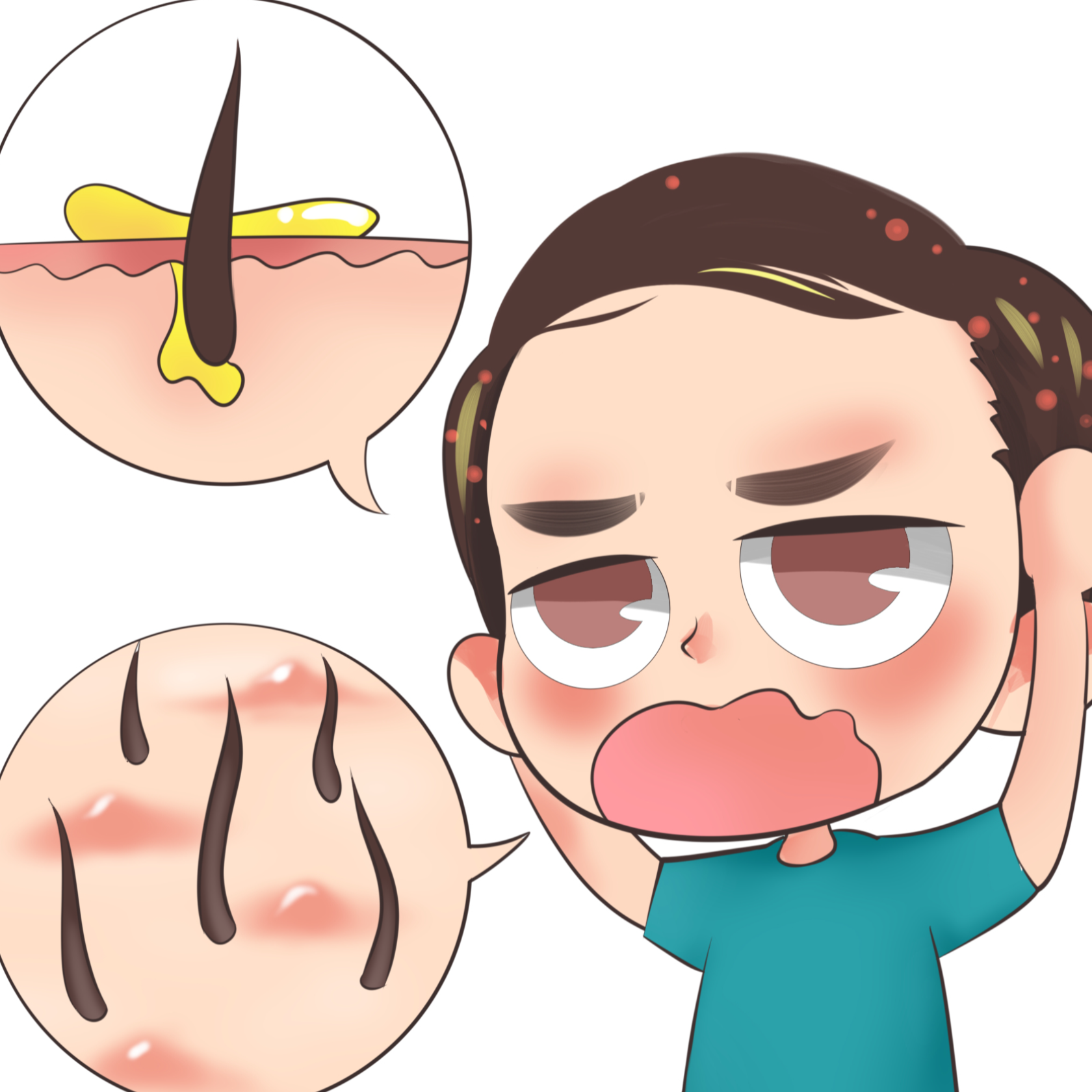 浑身易出油,以脸上,头上为重,兼有脱发,该怎样去缓解? - 知乎