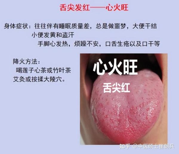 心火、胃火、肝火、肺火、肾火,五脏有“火”会出现什么信号?该怎么降火 - 知乎