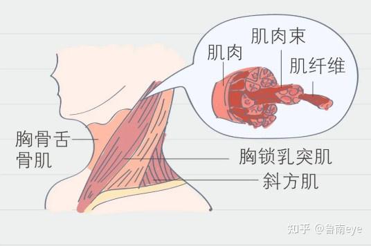 注意反复落枕要警惕