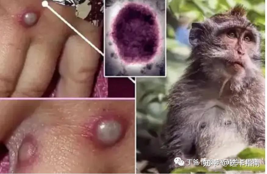 猴痘病毒(monkey pox virus),兔痘病毒(rabbit pox virus),水牛痘病毒