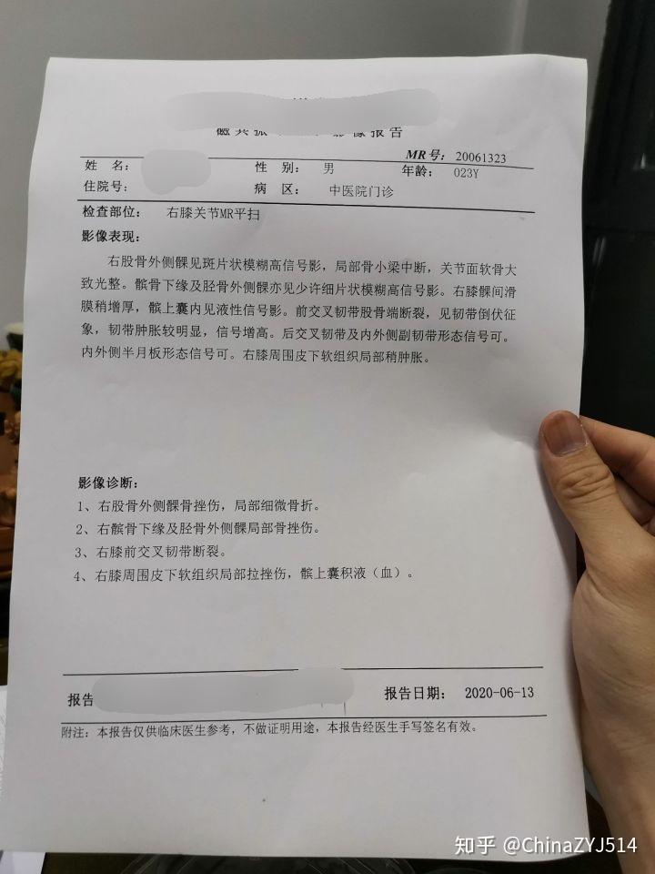 前交叉韧带断裂术前术后经历分享 - 知乎