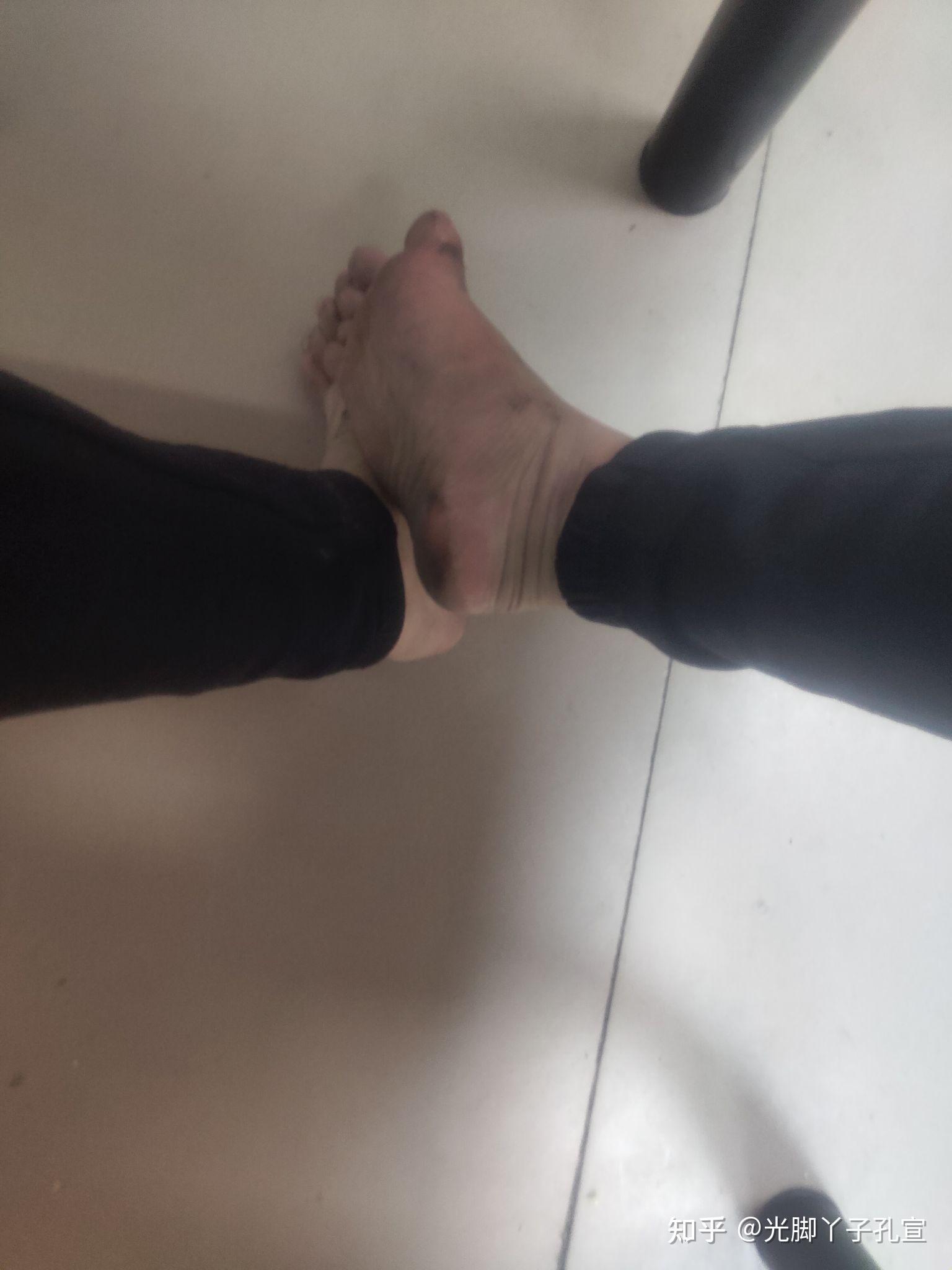 男孩子的脚底很嫩怎么样? - 知乎