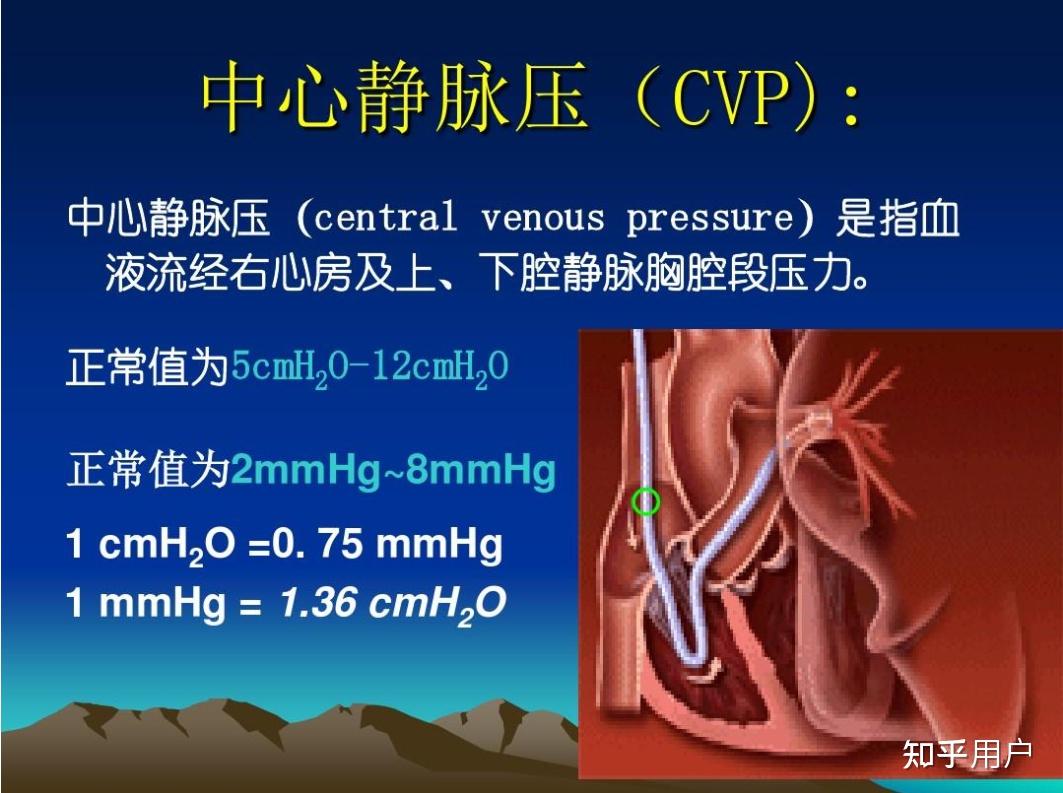 请问cvp正常值换算成毫米汞柱怎么换算?