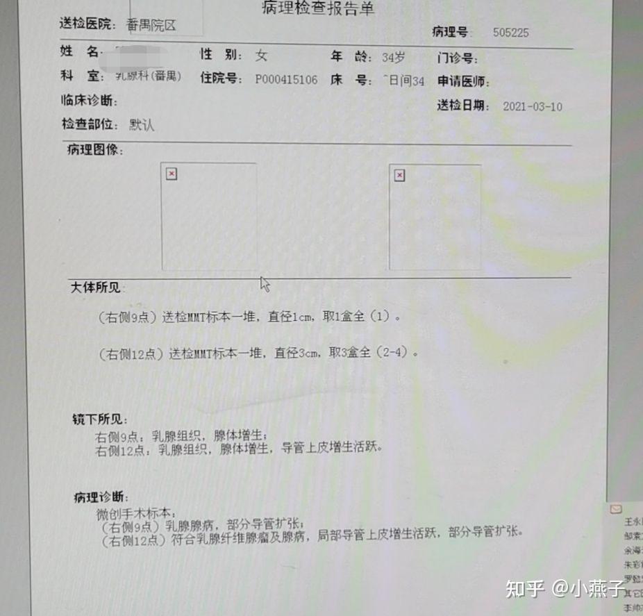 查出乳腺肿块,被医生告知要做穿刺活检的一周心路历程 - 知乎