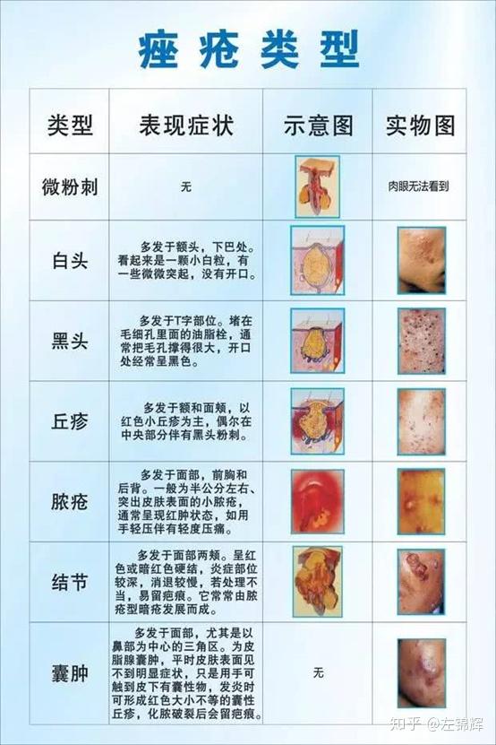 理肤泉的k乳可以和duo 一起用吗?