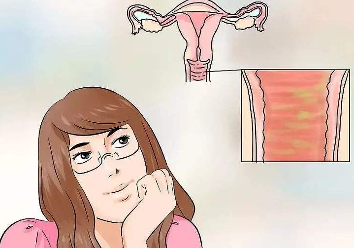 患者提问宫颈糜烂怎么办