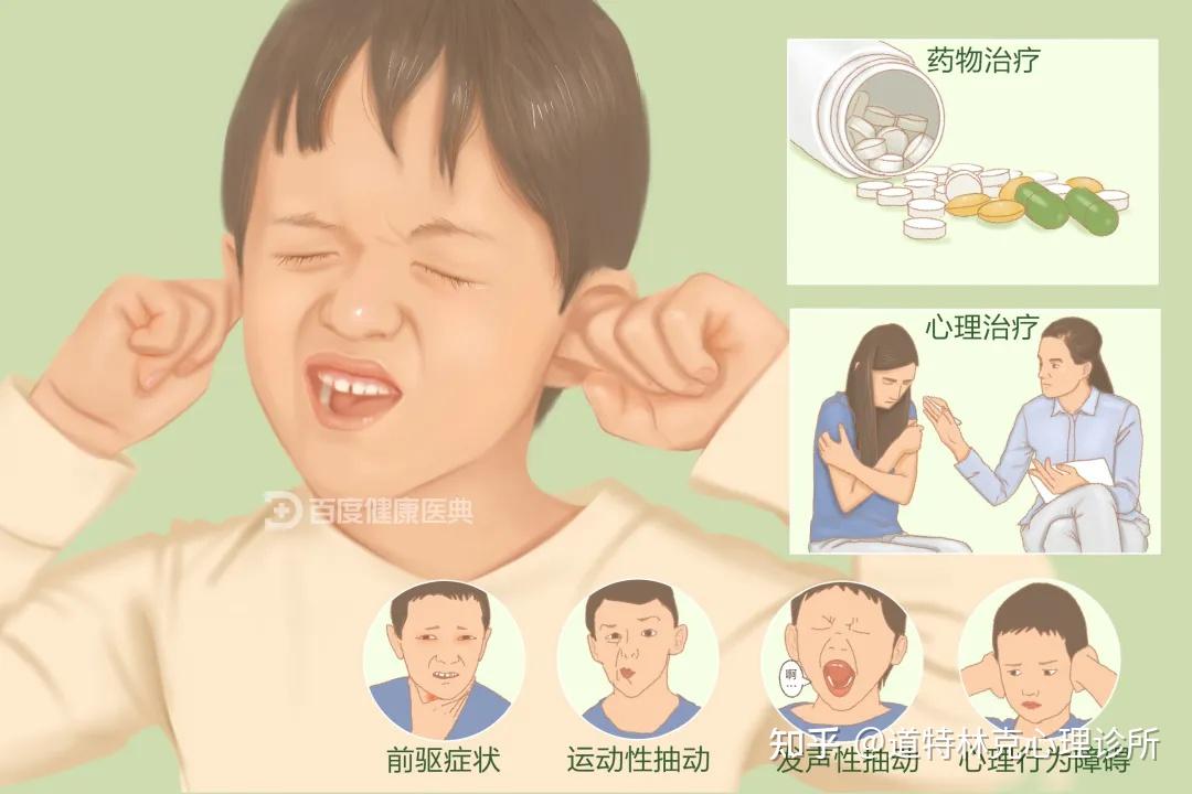 抽动障碍是一种起病于儿童和青少年时期,以不随意的突发,快速,重复,非