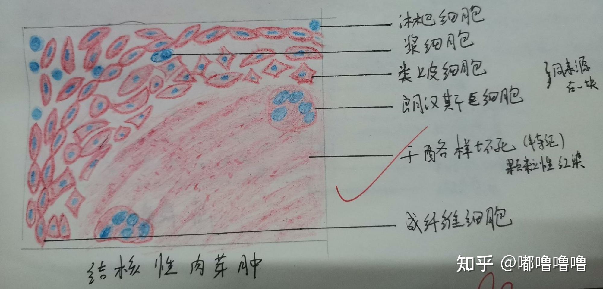 病理紅藍鉛筆手繪圖