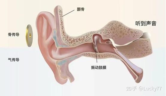骨传导耳机变得越来越火热,相比较入耳式的耳机,在佩戴它们运动的过程