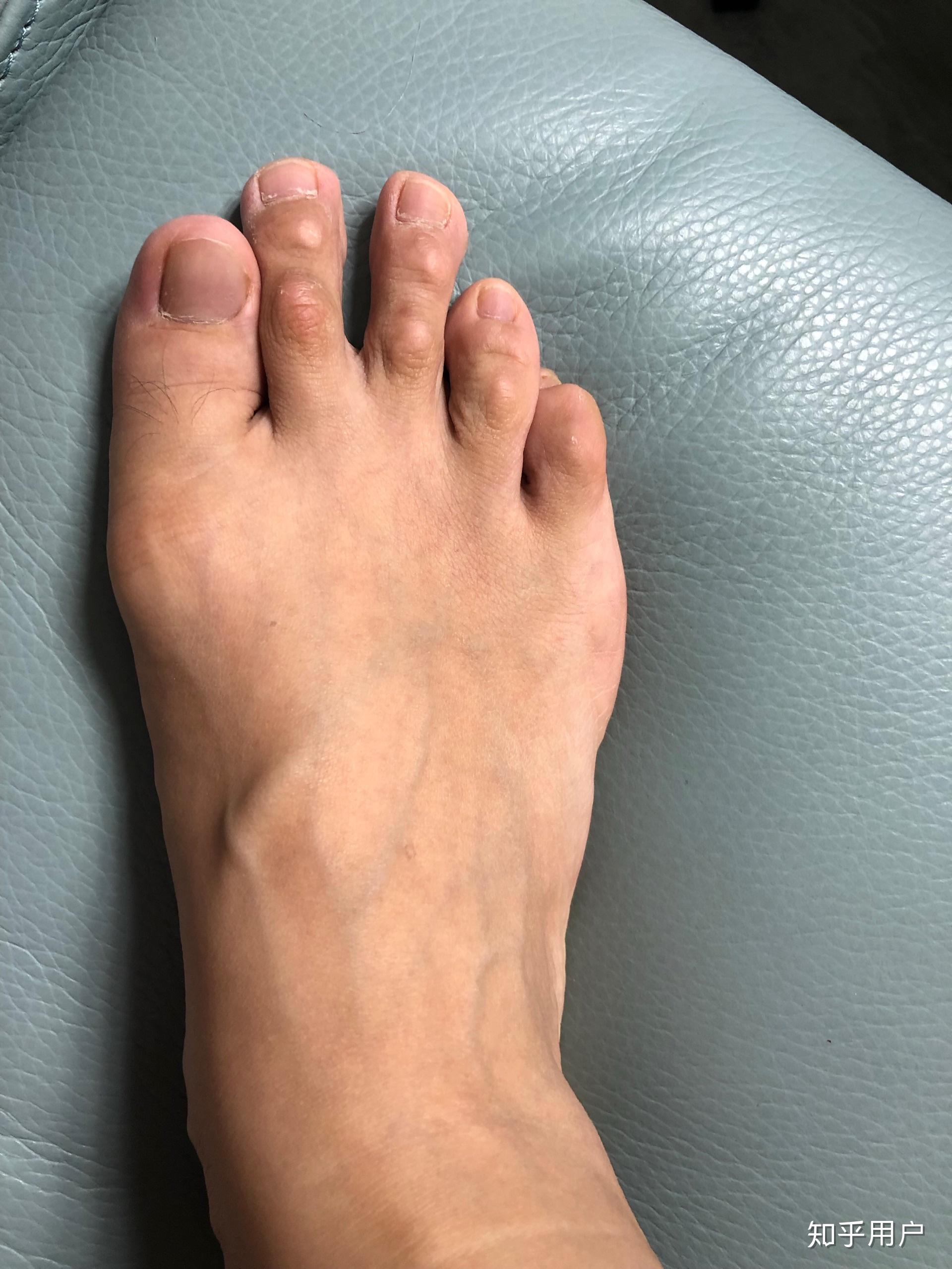 女生脚丑是种什么样的体验