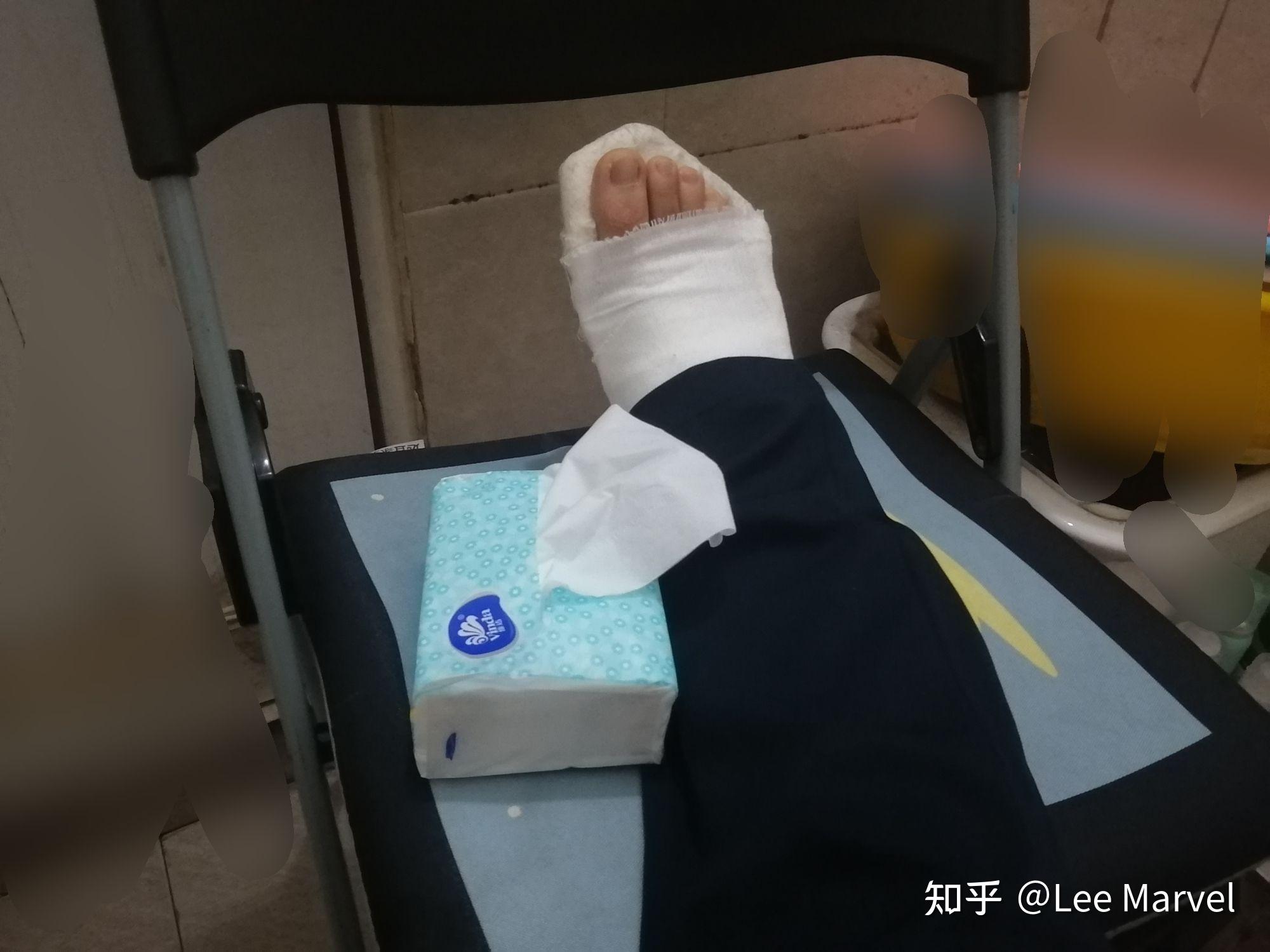 大学脚骨折无法走路怎么在宿舍赶上学习进度和调整身心状态