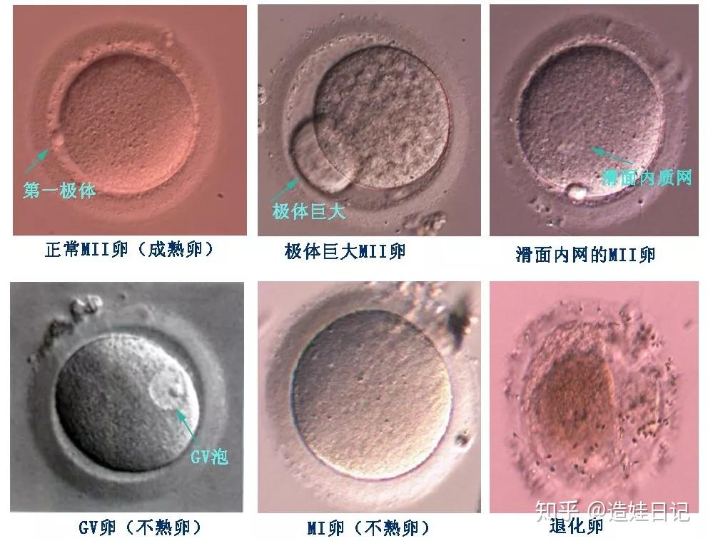 普通的光学显微镜无法看到卵母细胞的纺锤体