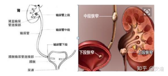 输尿管扩张器使用图解图片