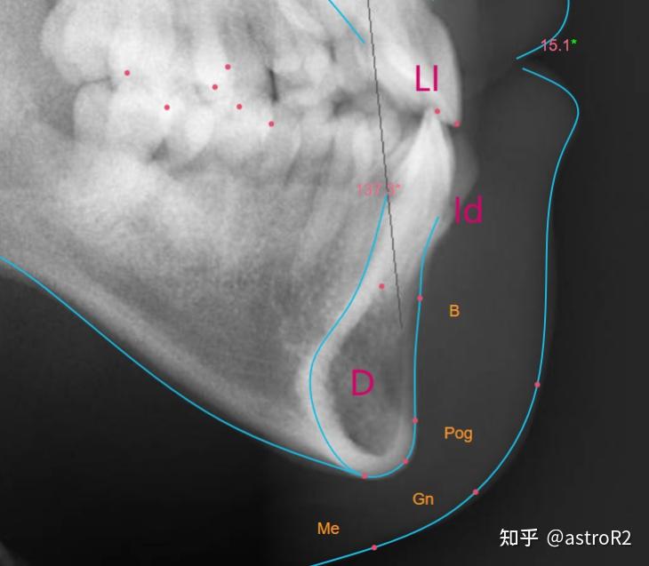 口腔 / 我和口腔科的故事(8): 北大口腔正畸篇-x线头影测量图解