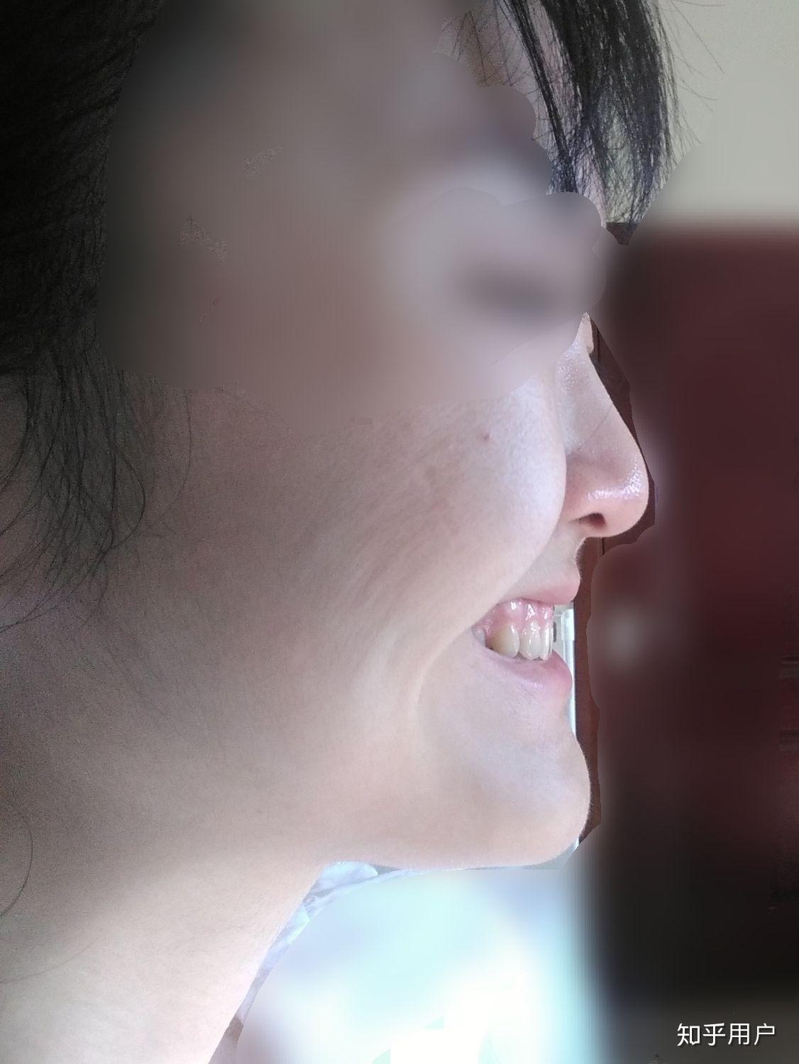 翘下巴月亮脸鞋拔子脸是不是很丑