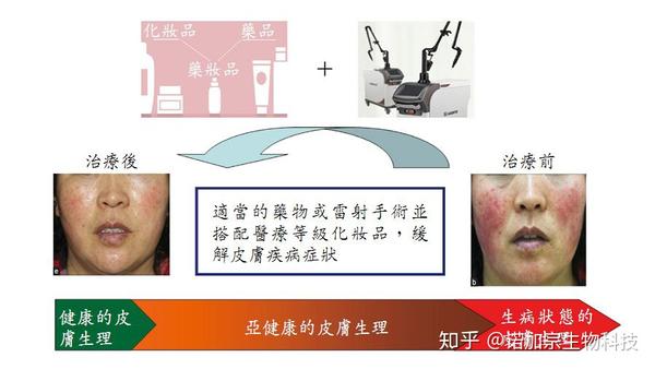 皮肤健康与化妆品_唯品会的丸美化妆品是正品吗_健康化妆美容论文