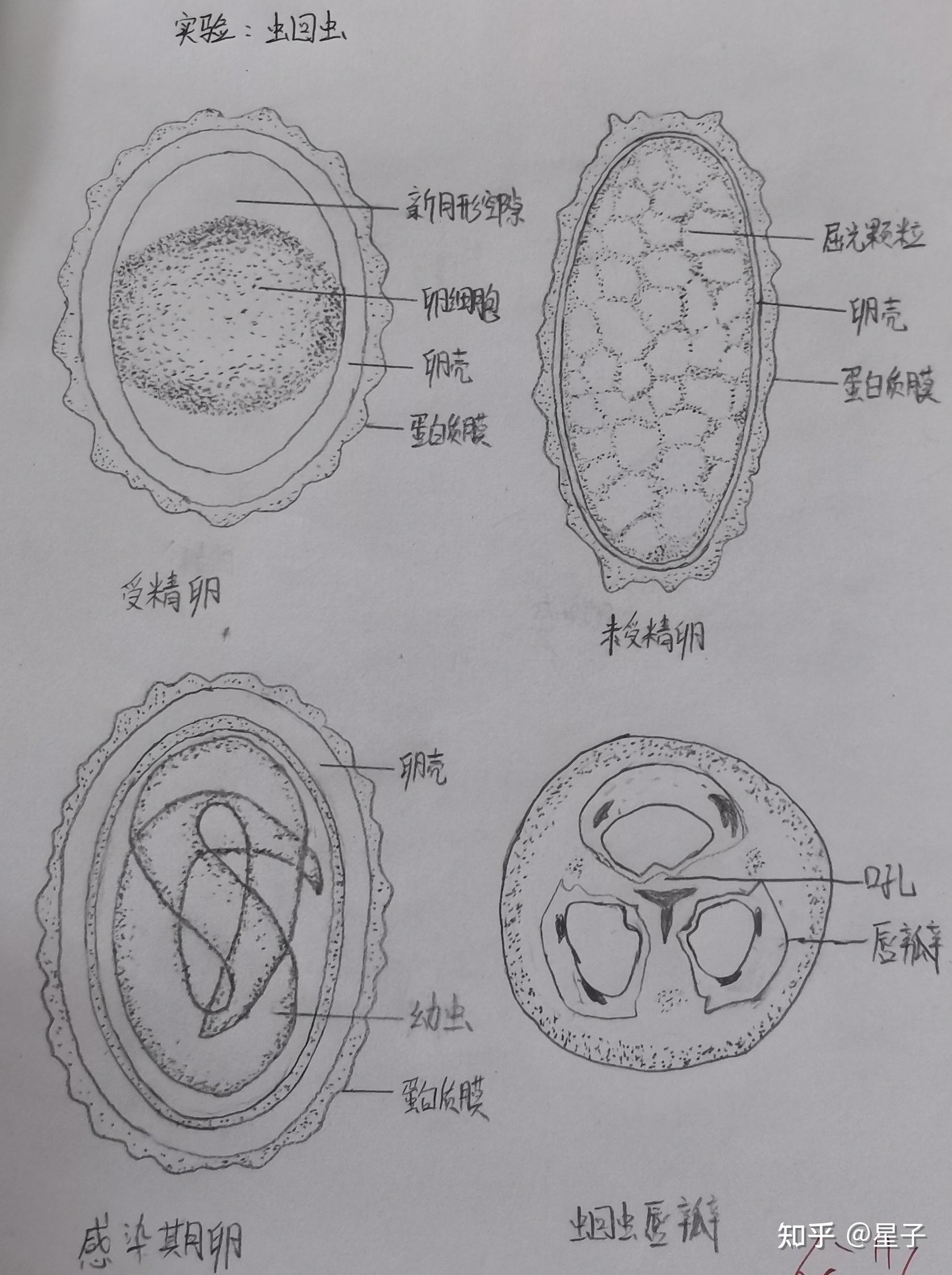 棘球蚴原头蚴手绘图图片