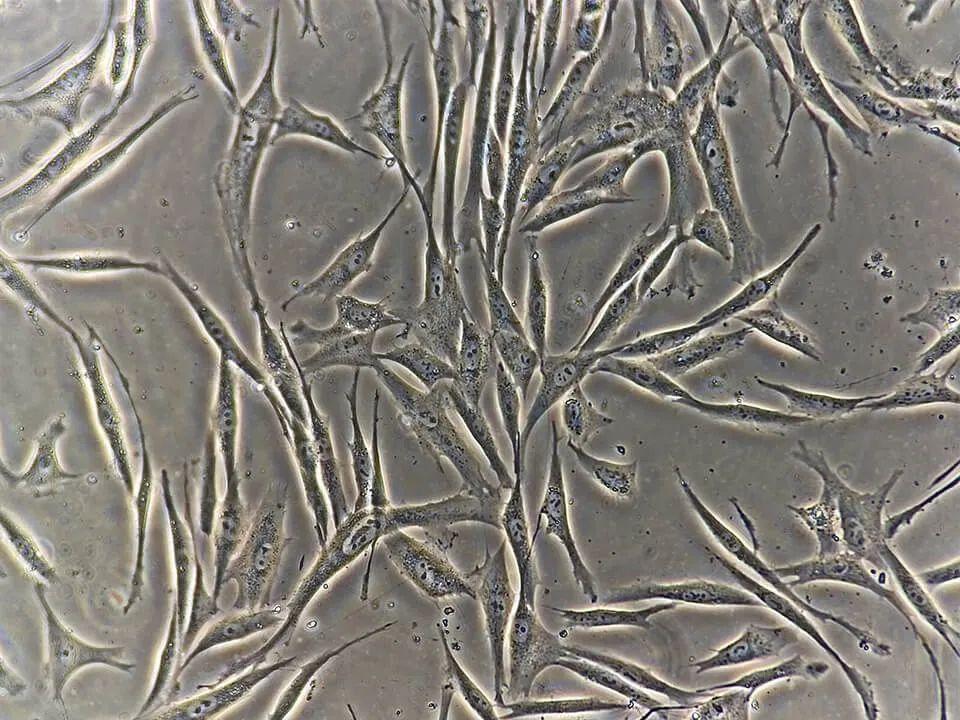 成人存储皮肤成纤维细胞,是为了将来换器官吗?