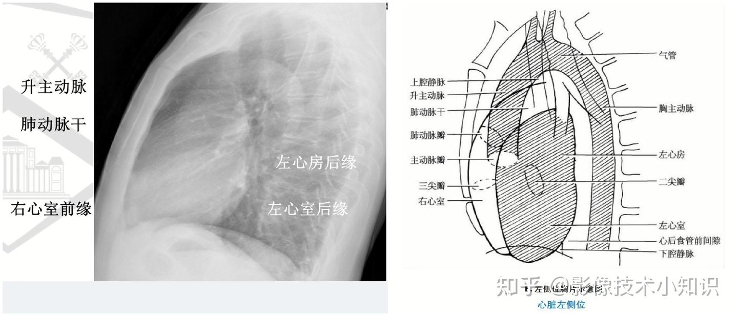 心脏的影像知识(2) - 知乎