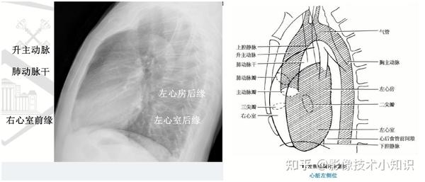 心脏的影像知识（2） - 知乎