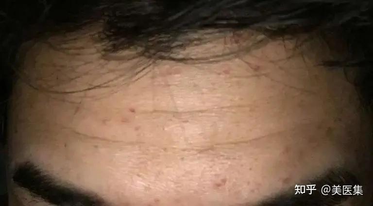 额头有纹的人注意了，你的运势正隐藏其中！ - 知乎