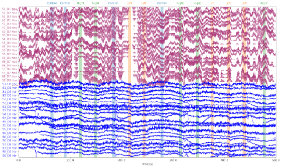 MNE/Python-fNIRS近红外数据处理中文手册 - 知乎