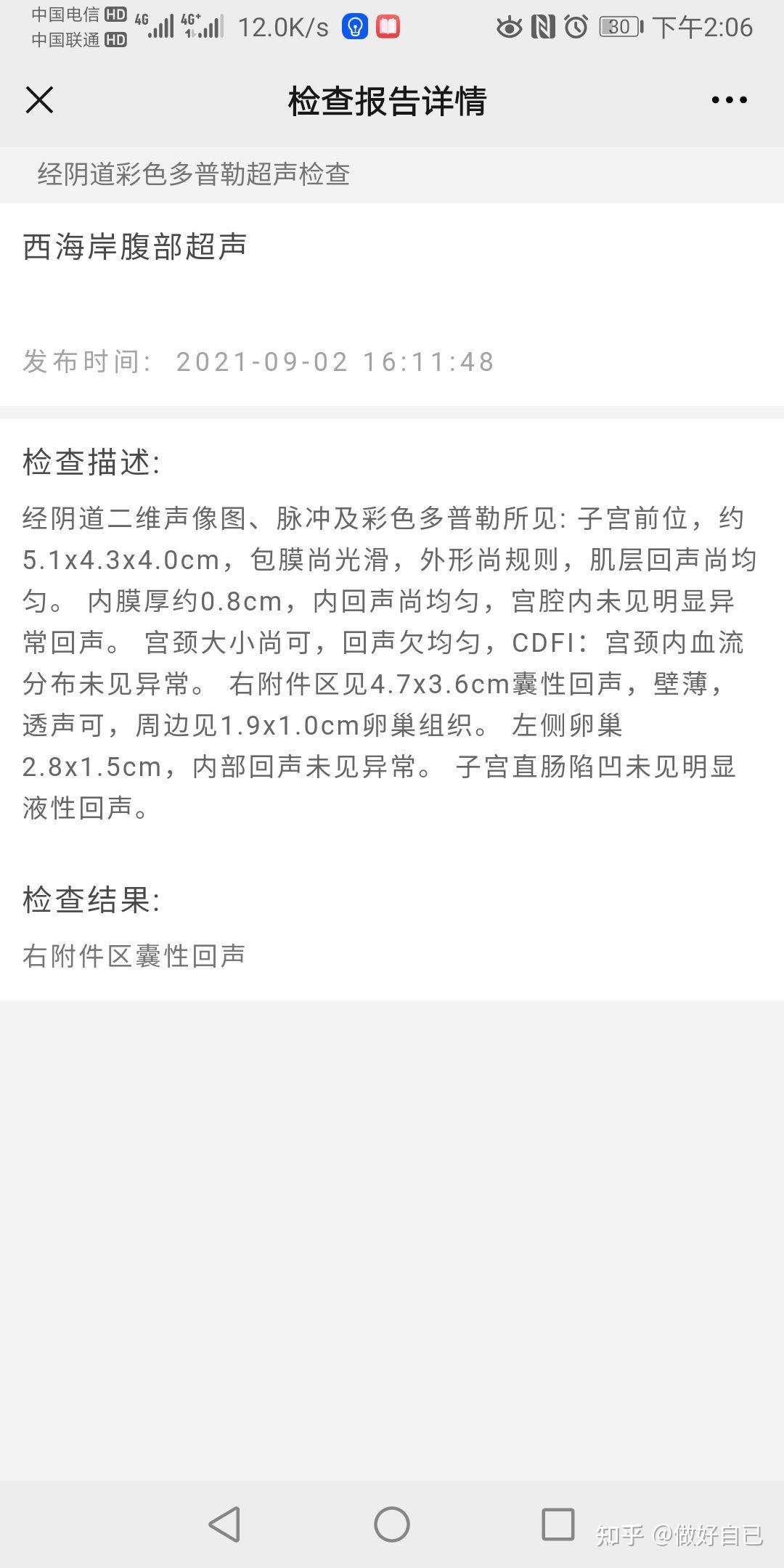 麻婆豆腐在日本算是第一知名中国名菜吗为什么 知乎