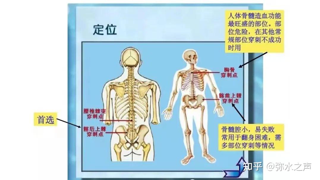 骨髓穿刺点图片