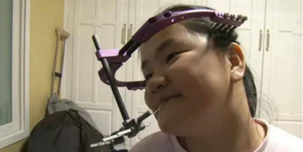 积极治疗的雅妍