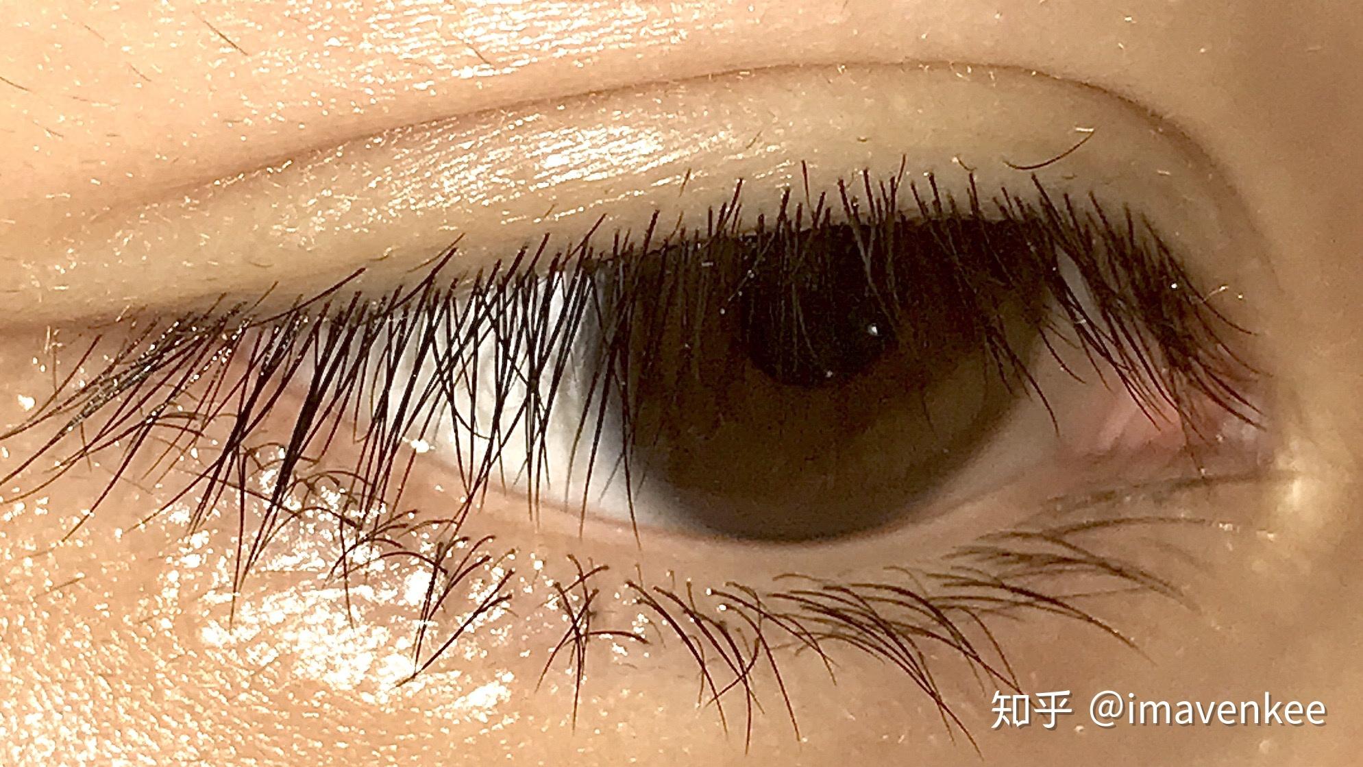 什么是双睫症身边有这样的朋友吗