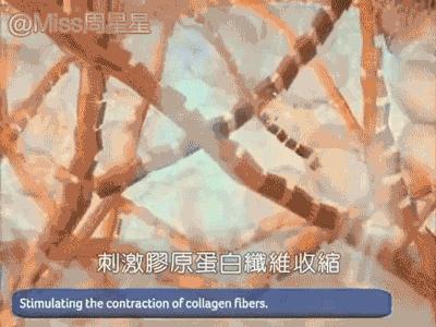 美容仪原理篇 网红美容仪真的有用吗 知乎