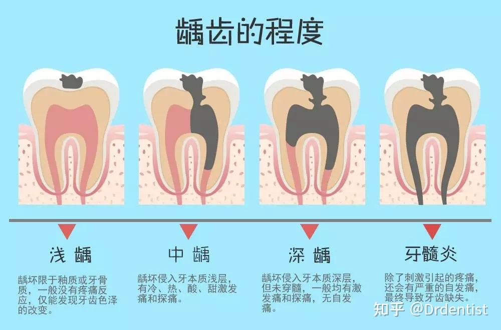 1分鐘教你接吻不被拒每天刷牙漱口仍牙齦出血口臭蛀牙你漏了這一個