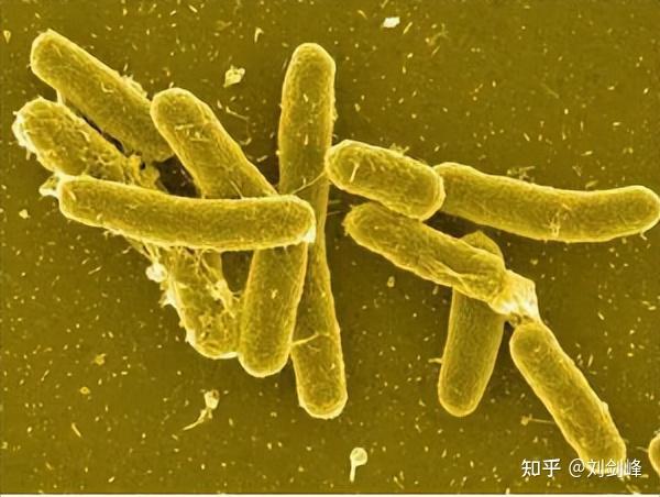 沙门氏菌(salmonella)属于肠杆菌科,显微镜下看,它长得像一根棍子