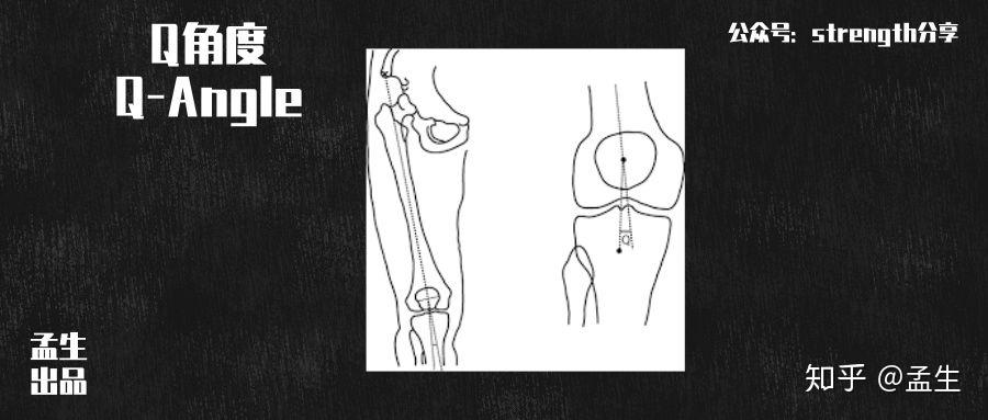 结节连线与股四头肌牵拉力线相交之角即为q角正常q角男性10-15