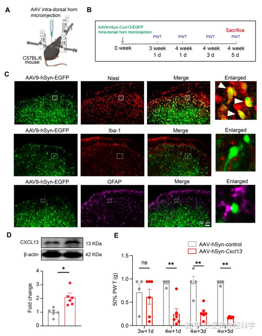 Journal Of Neuroinflammation︱浙江中医药大学刘伯一/方剑乔团队揭示趋化因子CXCL13/CXCR5通路参与复杂性 ...