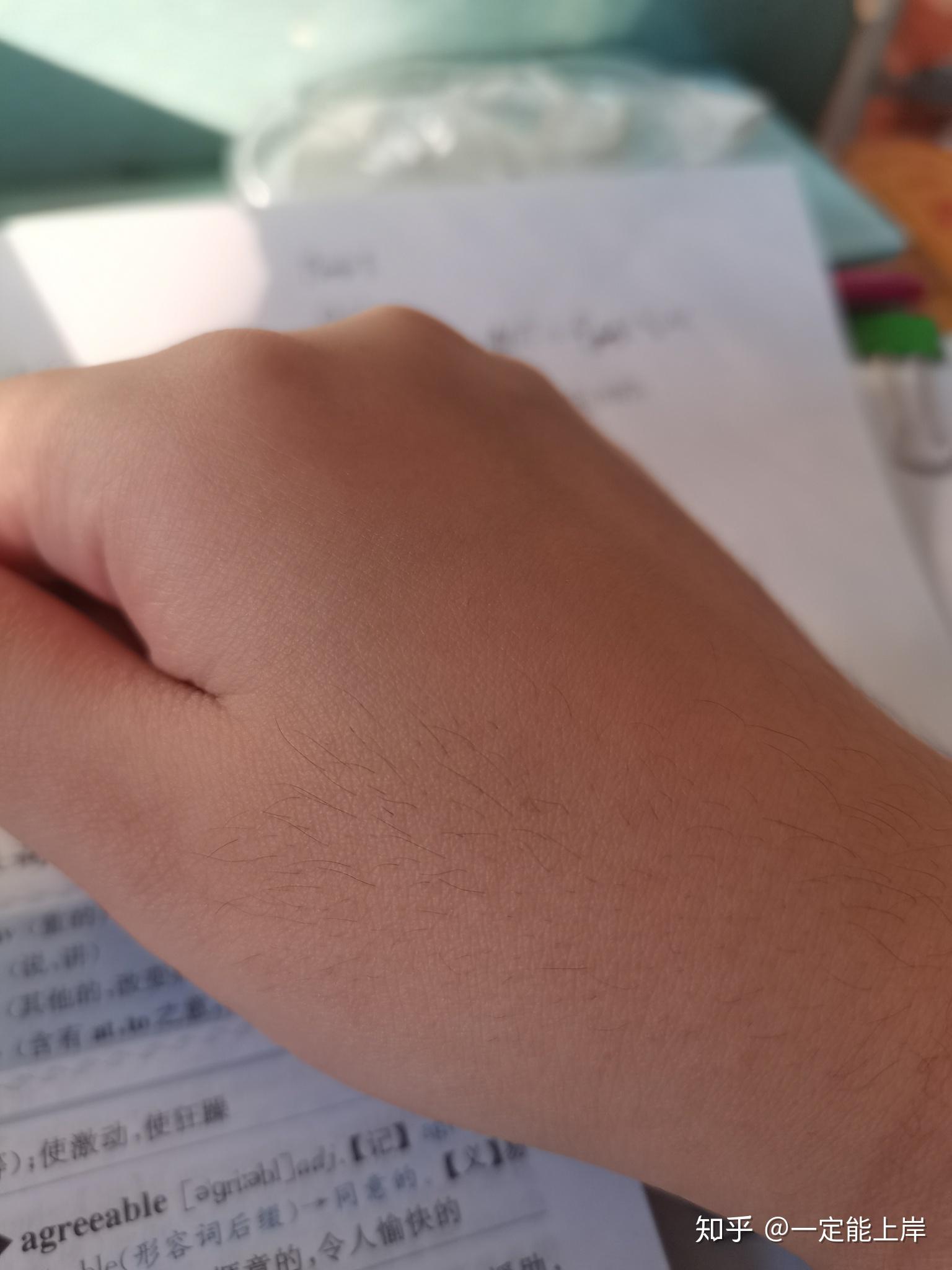 我是女生,手背上汗毛很多,毛孔特别大,密密麻麻的,大家有紧毛孔的办法