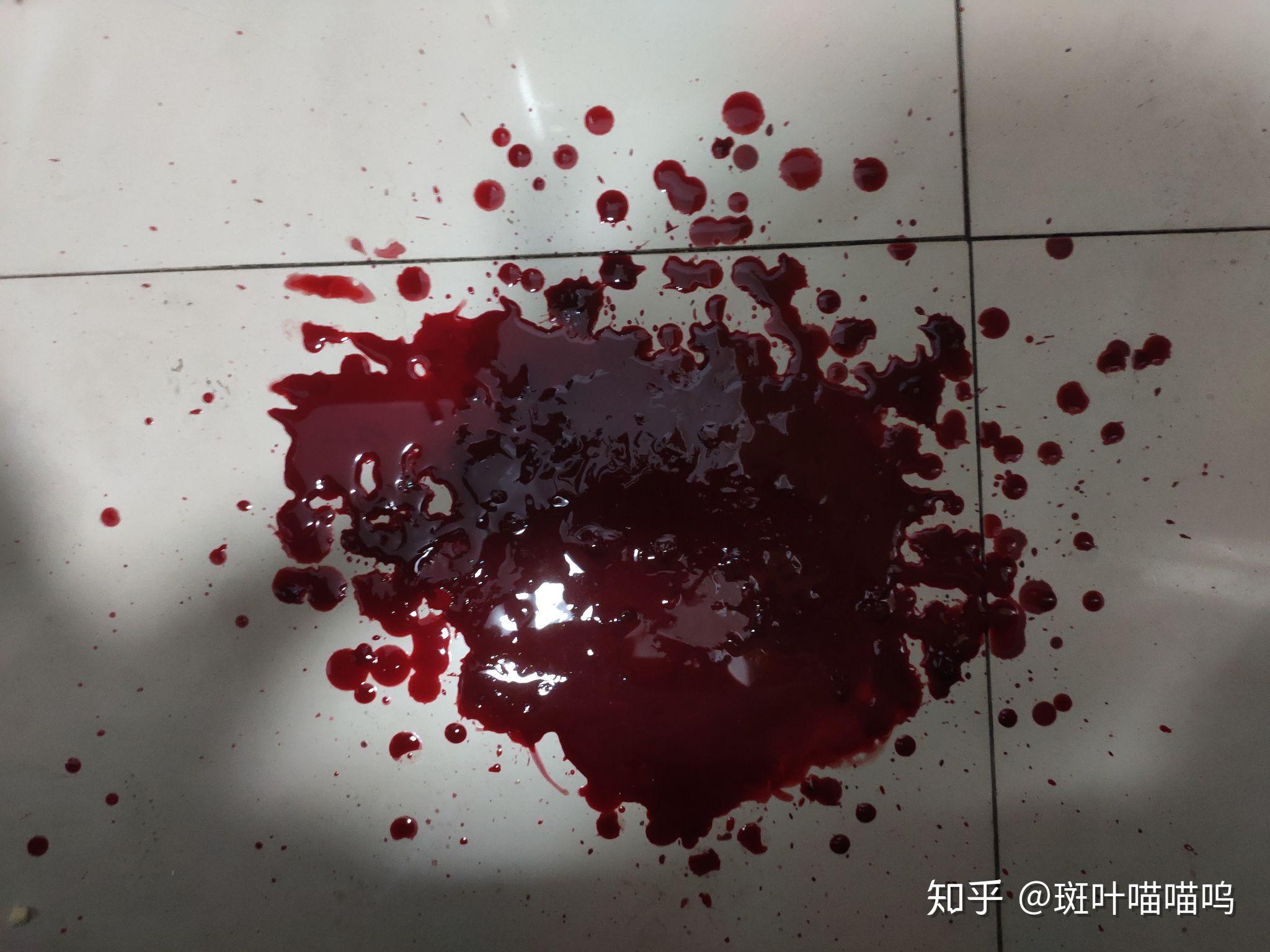 别人会不会看不起自残的人? - 知乎