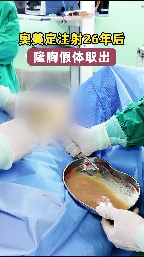 奥美定注射隆胸26年后 胸部突现不明肿块