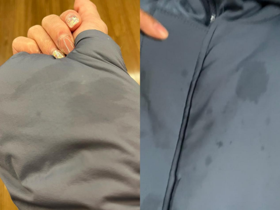 油渍弄到衣服上怎么洗干净啊?最好是不用洗整件衣服的办法!教你一招,顽固油渍也能轻松拿下!