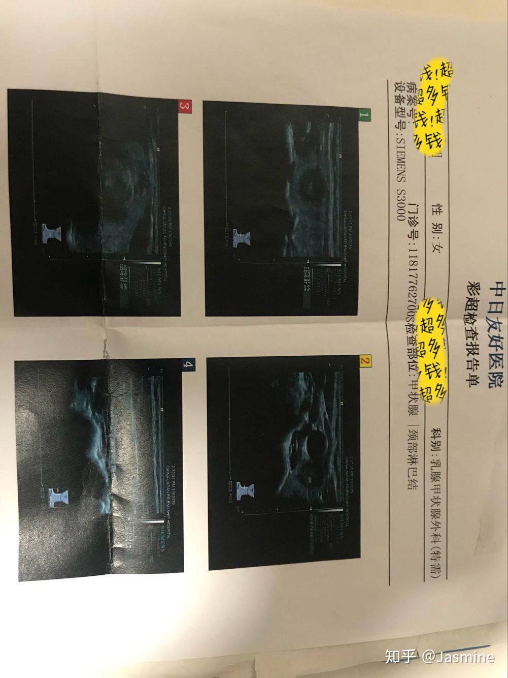 北京肿瘤医院、密云区贩子挂号,确实能挂到号!的简单介绍