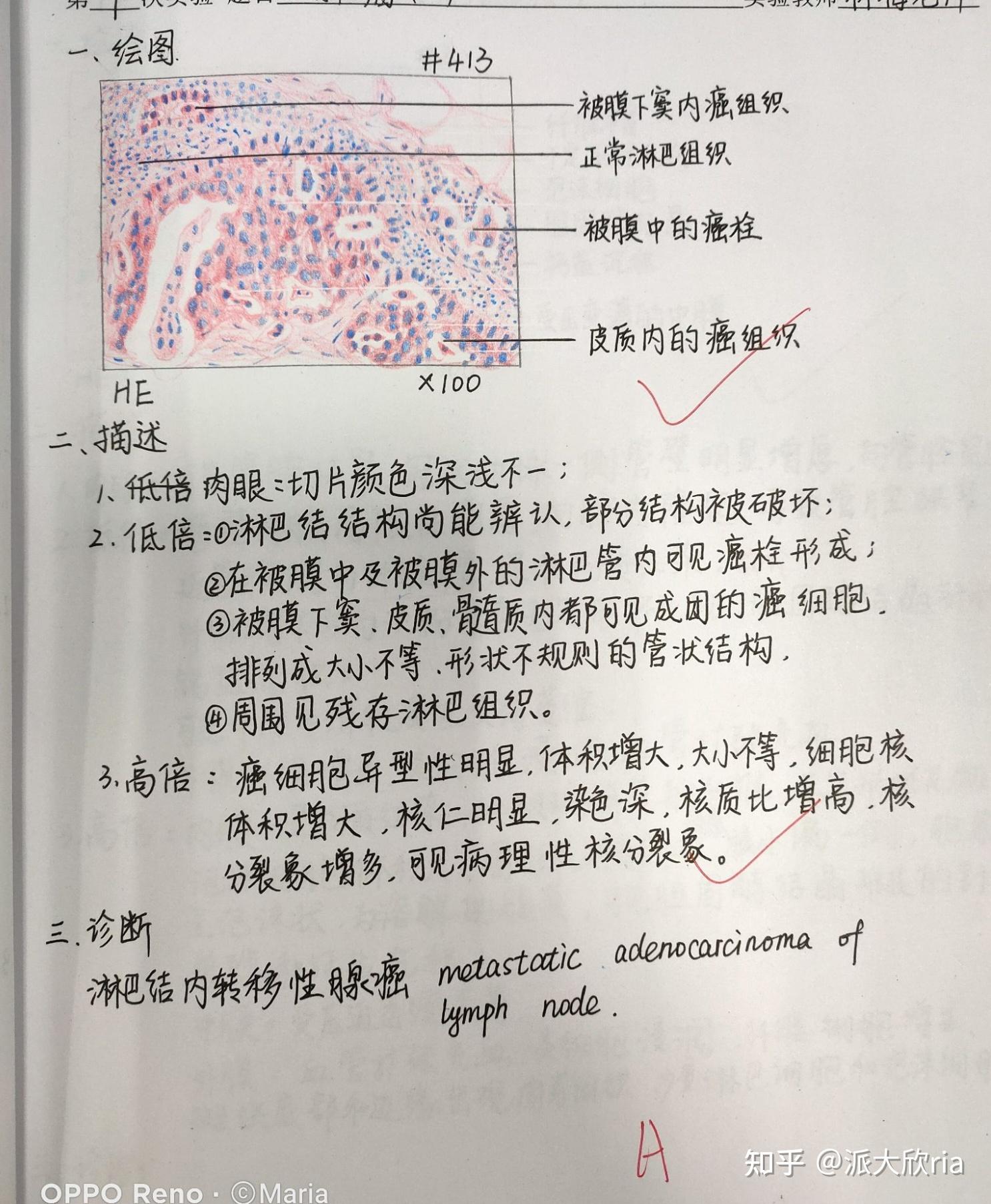 病理学实验报告红蓝铅笔手绘图有老师批改 