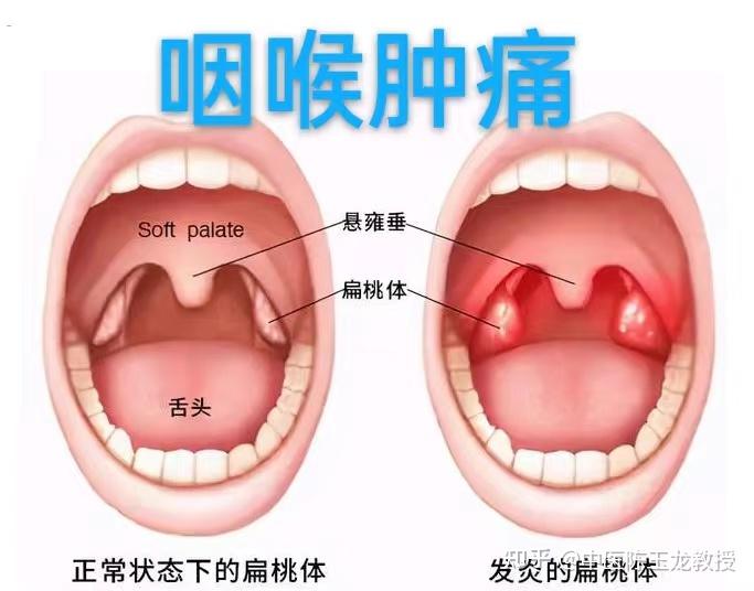 送你一味化痰药