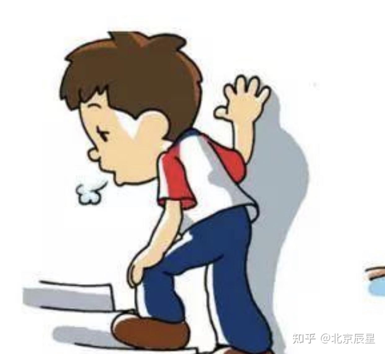 什么是猝倒发作有哪些表现