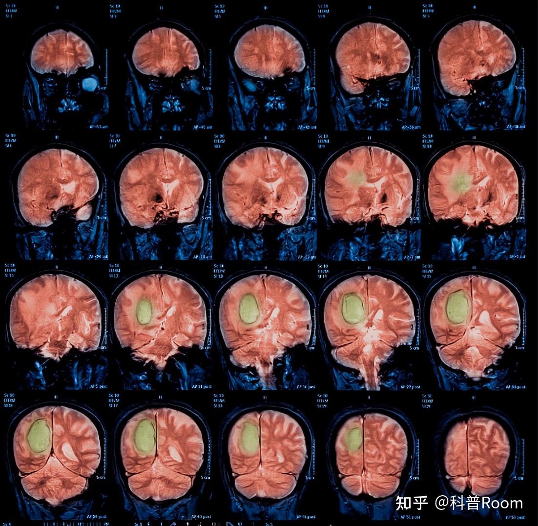 醫療中必不可少的核磁共振儀