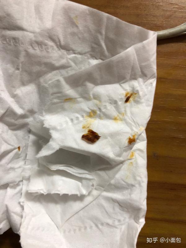 人类需要定时为自己挖耳屎吗?