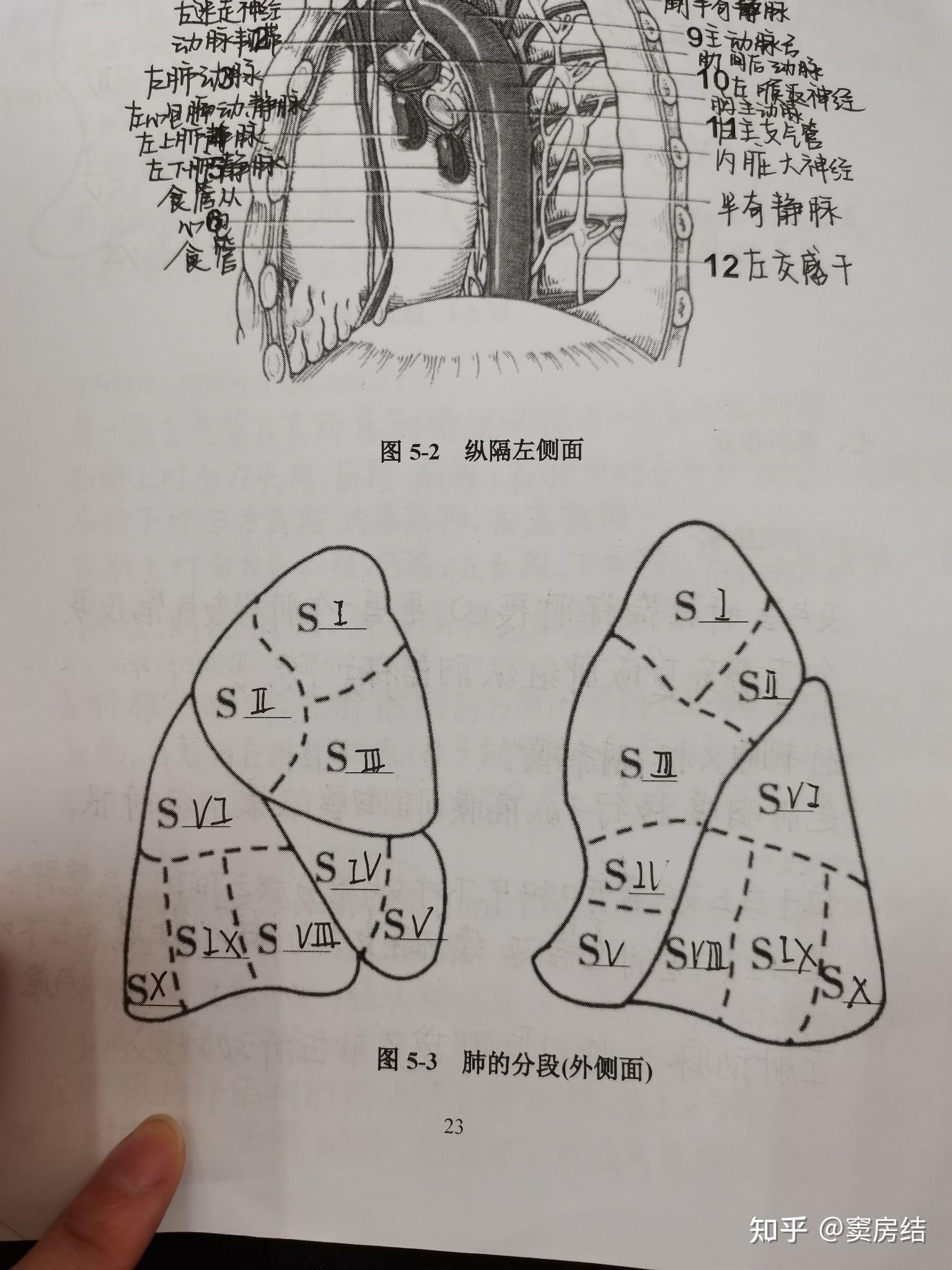 肺部断层 - 知乎