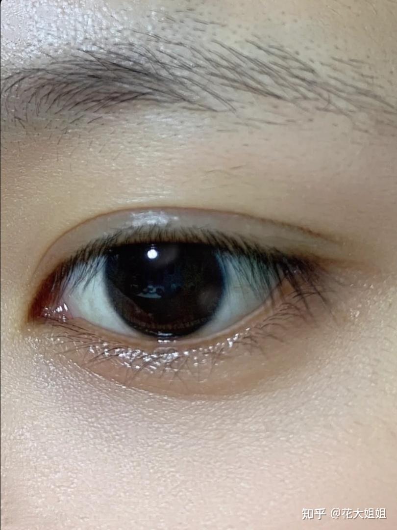 怎么区分眼下干纹和细纹? - 知乎